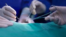 Surgeons doing surgery 